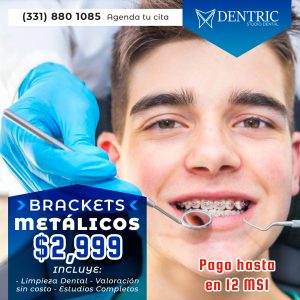 metalicos-cuadrado-dentric