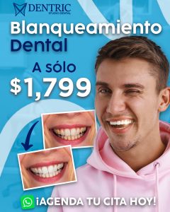 Rediseño-dentric-promo-blanqueamiento-dental_02