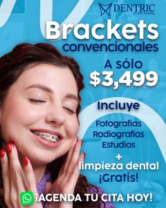 Rediseño-dentric-promo-bracket-convevncional_02