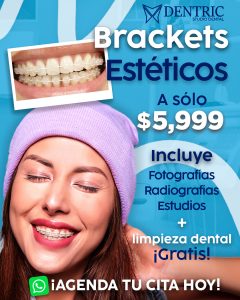 Rediseño-dentric-promo-brackets-esteticos_02
