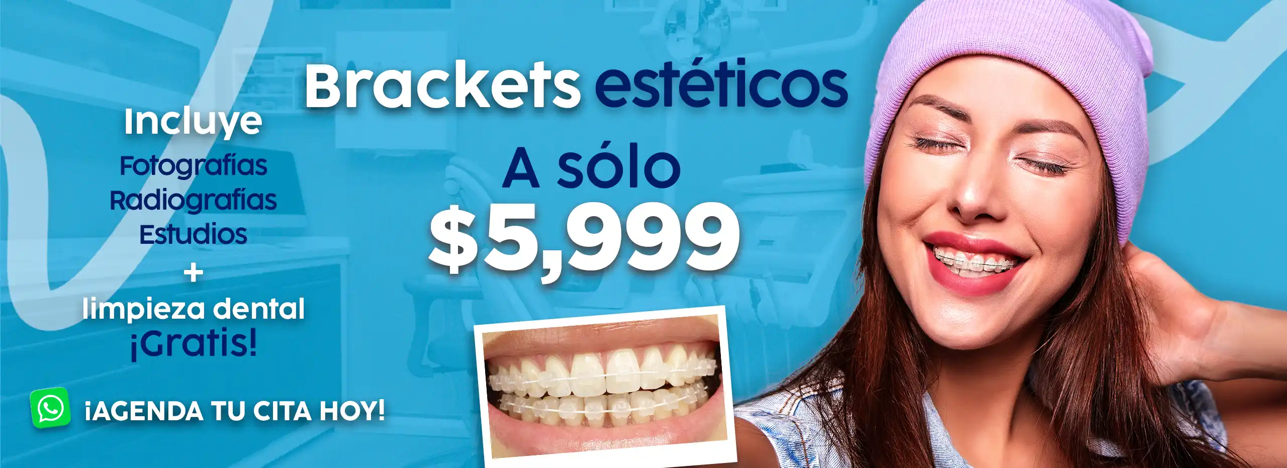Hero Dentric Brackets estéticos