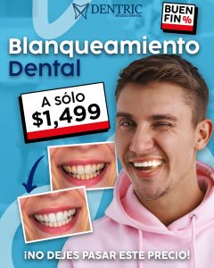 Blanqueamiento-Buen-fin-Pagina-Dentric_02