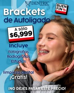 Brackets-de-autoligado-Buen-fin-Pagina-Dentric_02