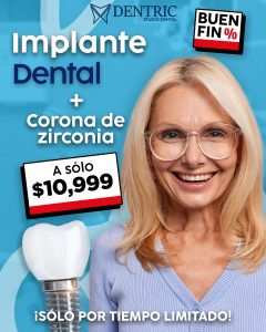 Implante-mas-corona-Buen-fin-Paginal-Dentric_02