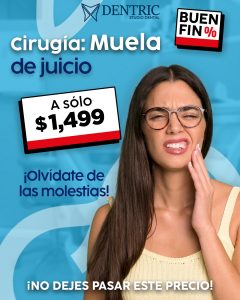 Muela-de-juico-Buen-fin-Pagina-Dentric_02