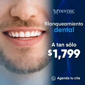 dentric_blanqueamiento_cuadrado
