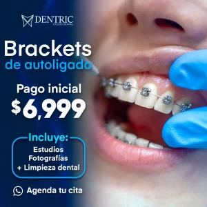 promo_cuadrada_dentric_brackets_autoligado