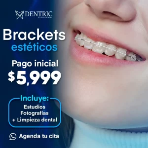 promo_cuadrada_dentric_brackets_esteticos