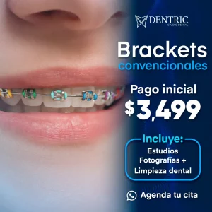 promo_cuadrada_dentric_brackets_normales